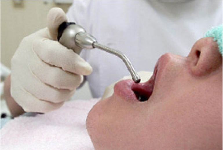インプラントとは、乳歯、永久歯に継ぐ第3の歯と言われています。